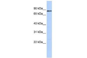 WB Suggested Anti-MYBL1 Antibody Titration:  0. (MYBL1 Antikörper  (Middle Region))