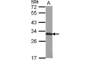 Image no. 1 for anti-Quinoid Dihydropteridine Reductase (QDPR) (AA 1-244) antibody (ABIN1501905)