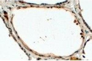 AP23774PU-N DUOX1 antibody staining of paraffin embedded Human Thyroid Gland at 4 µg/ml.