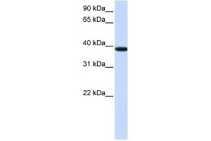 KLHDC8B antibody used at 1 ug/ml to detect target protein.