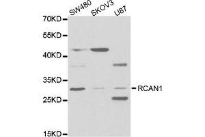 Western Blotting (WB) image for anti-Regulator of Calcineurin 1 (RCAN1) antibody (ABIN1876514)