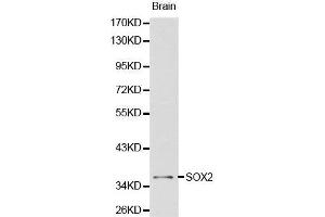 Western Blotting (WB) image for anti-SRY (Sex Determining Region Y)-Box 2 (SOX2) (AA 1-140) antibody (ABIN3021003) (SOX2 Antikörper  (AA 1-140))