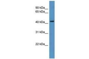 Image no. 1 for anti-UDP-Gal:betaGlcNAc beta 1,4-Galactosyltransferase, Polypeptide 6 (B4GALT6) (AA 291-340) antibody (ABIN6746271) (B4GALT6 Antikörper  (AA 291-340))