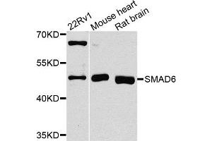 Western blot analysis of extracts of various cells, using SMAD6 antibody.