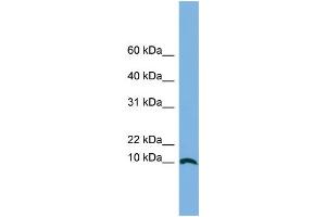 WB Suggested Anti-STRA13 Antibody Titration: 0. (STRA13 Antikörper  (Middle Region))