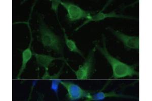 Immunofluorescence analysis of U-251 MG cells using FABP7 Polyclonal Antibody at dilution of 1:100. (FABP7 Antikörper)