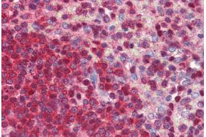 Immunohistochemistry (Paraffin-embedded Sections) (IHC (p)) image for anti-Nuclear Receptor Subfamily 0, Group B, Member 2 (NR0B2) (AA 110-159) antibody (ABIN6741607)
