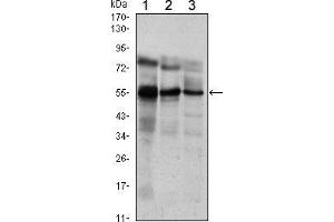 Western blot analysis using ETV5 mouse mAb against Jurkat (1), NIH/3T3 (2) and MCF-7 (3) cell lysate.