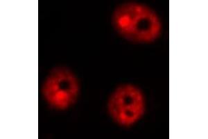 Immunofluorescence (fixed cells) (IF/ICC) image for anti-DNA-Damage-Inducible Transcript 3 (DDIT3) (pSer30) antibody (ABIN6256253)