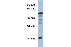 WB Suggested Anti-PGDS Antibody Titration:  0. (PTGDS Antikörper  (N-Term))