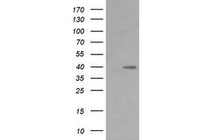 Image no. 2 for anti-Mitogen-Activated Protein Kinase Kinase 3 (MAP2K3) antibody (ABIN1499409)