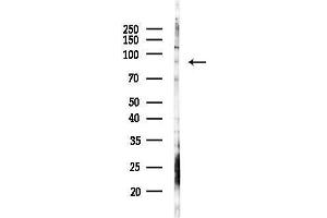 anti-rho GTPase Activating Protein 21 (ARHGAP21) (Internal Region) antibody