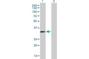 Western Blot analysis of ZNF124 expression in transfected 293T cell line by ZNF124 MaxPab polyclonal antibody. (ZNF124 Antikörper  (AA 1-289))