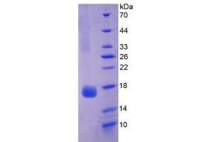 SDS-PAGE of Protein Standard from the Kit (Highly purified E. (Myoglobin CLIA Kit)