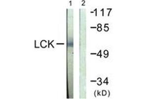 Western blot analysis of extracts from Jurkat cells, using Lck (Ab-505) Antibody. (LCK Antikörper  (AA 460-509))