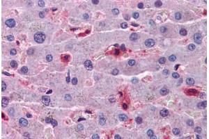 Human Liver: Formalin-Fixed, Paraffin-Embedded (FFPE) (Hepcidin Antikörper  (AA 25-85))