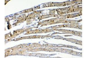 Immunohistochemistry (IHC) image for anti-Catenin (Cadherin-Associated Protein), beta 1, 88kDa (CTNNB1) (AA 2-233) antibody (ABIN5518980)