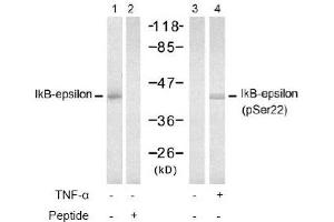 Image no. 2 for anti-Nuclear Factor of kappa Light Polypeptide Gene Enhancer in B-Cells Inhibitor, epsilon (NFKBIE) (Ser22) antibody (ABIN197571) (NFKBIE Antikörper  (Ser22))