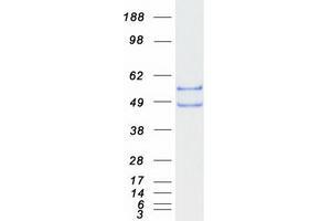 Validation with Western Blot (BCAT1 Protein (Myc-DYKDDDDK Tag))