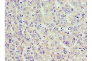 Immunohistochemistry of paraffin-embedded human placenta tissue using ABIN7158557 at dilution of 1:100 (ACP1 Antikörper  (AA 1-158))