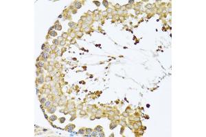 Immunohistochemistry of paraffin-embedded mouse testis using CCT4 antibody (ABIN5973931) at dilution of 1/100 (40x lens). (CCT4 Antikörper)
