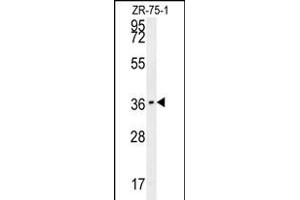 CLEC12A Antibody (Center) (ABIN653995 and ABIN2843932) western blot analysis in ZR-75-1 cell line lysates (35 μg/lane). (CLEC12A Antikörper  (AA 178-206))