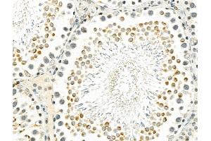 ABIN7094329 and ABIN7098376 at 1/100 staining Rat testis tissue by IHC-P. (ZNF426 Antikörper  (Internal Region))