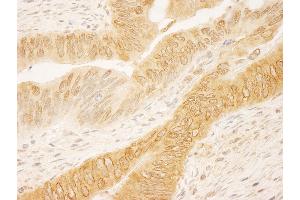 Immunohistochemistry (IHC) image for anti-Ran GTPase Activating Protein 1 (RANGAP1) (AA 400-450) antibody (ABIN7454428)