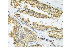 Immunohistochemistry of paraffin-embedded Human prostate using HLA-DQA1 Polyclonal Antibody at dilution of 1:100 (40x lens). (HLA-DQA1 Antikörper)