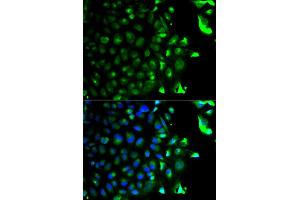 Immunofluorescence analysis of HeLa cells using RAB5A antibody. (RAB5 Antikörper)