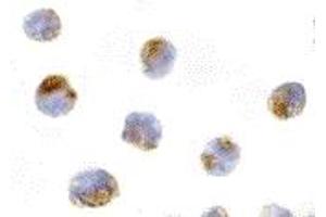 Immunohistochemistry (IHC) image for anti-Induced Myeloid Leukemia Cell Differentiation Protein Mcl-1 (MCL1) (Middle Region) antibody (ABIN1030997) (MCL-1 Antikörper  (Middle Region))