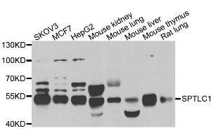 Western blot analysis of extracts of various cell lines, using SPTLC1 antibody. (SPTLC1 Antikörper  (AA 37-310))