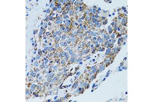 Immunohistochemistry (Paraffin-embedded Sections) (IHC (p)) image for anti-Mitochondrial Ribosomal Protein L28 (MRPL28) (AA 1-256) antibody (ABIN6144010)