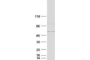 Validation with Western Blot (AP2M1 Protein (Transcript Variant 2) (Myc-DYKDDDDK Tag))