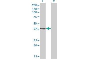 Western Blotting (WB) image for anti-DNA Repair Protein RAD51 Homolog 3 (RAD51C) (AA 1-134) antibody (ABIN562569)
