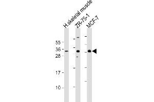 All lanes : Anti-FGF17 Antibody (N-Term) at 1:2000 dilution Lane 1: human skeletal muscle lysates Lane 2: ZR-75-1 whole cell lysates Lane 3: MCF-7 whole cell lysates Lysates/proteins at 20 μg per lane. (FGF17 Antikörper  (AA 78-112))