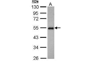 WB Image Sample (30 ug of whole cell lysate) A: Hep G2 , 10% SDS PAGE antibody diluted at 1:1000 (CCDC83 Antikörper)