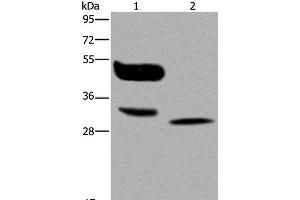 Western Blot analysis of A375 cell and Human lung cancer tissue using MAGEA8 Polyclonal Antibody at dilution of 1:400 (MAGEA8 Antikörper)