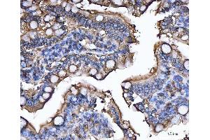 IHC analysis of CD13/Anpep using anti-CD13/Anpep antibody (ABIN7602222). (CD13 Antikörper  (AA 642-965))