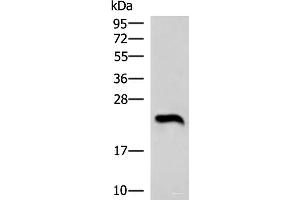 Western blot analysis of Human heart tissue lysate using NEUROG3 Polyclonal Antibody at dilution of 1:1000 (Neurogenin 3 Antikörper)