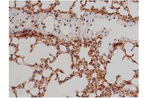 ABIN6267333 at 1/200 staining Mouse lung tissue sections by IHC-P. (SP1 Antikörper  (pThr453))