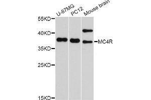 Western blot analysis of extracts of various cell lines, using MC4R Antibody. (MC4R Antikörper)