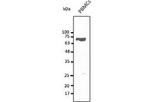Western Blotting (WB) image for anti-CD5 (CD5) (AA 105-210) antibody (ABIN7272988) (CD5 Antikörper  (AA 105-210))