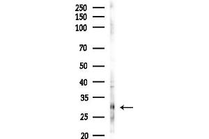 anti-Mitochondrial Ribosomal Protein S15 (MRPS15) (Internal Region) antibody