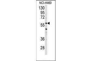 Image no. 1 for anti-Cytochrome P450, Family 3, Subfamily A, Polypeptide 4 (CYP3A4) (Middle Region) antibody (ABIN360097)
