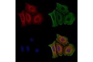 ABIN6255803 and ABIN6267342 staining HepG2 cells(4h of LPS treatment) by IF/ICC.