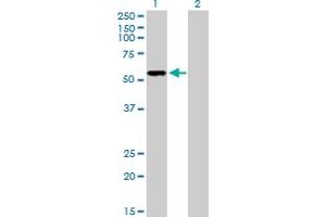 Western Blotting (WB) image for anti-Purinergic Receptor P2X, Ligand-Gated Ion Channel, 5 (P2RX5) (AA 1-422) antibody (ABIN518568)