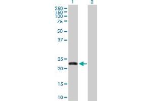 Western Blot analysis of FBXO36 expression in transfected 293T cell line by FBXO36 MaxPab polyclonal antibody. (FBXO36 Antikörper  (AA 1-188))