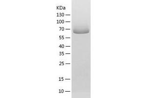 Western Blotting (WB) image for Acyl-CoA Synthetase Family Member 2 (ACSF2) (AA 42-615) protein (His tag) (ABIN7288288) (ACSF2 Protein (AA 42-615) (His tag))