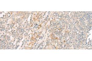 Immunohistochemistry of paraffin-embedded Human tonsil tissue using HBE1 Polyclonal Antibody at dilution of 1:30(x200)